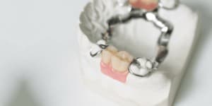 Naprawa protezy zębowej w Poznaniu