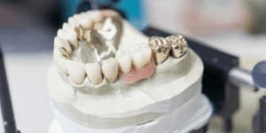 Proteza zębowa naprawa